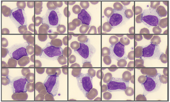 Nueva imagen de interés de citología sanguínea