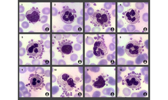 Nueva imagen de la Comisión de Biología Hematológica